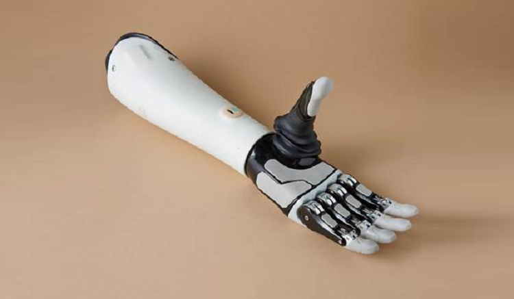 «Моторика» создала прототип ИИ-интерфейса для управления бионической кистью
