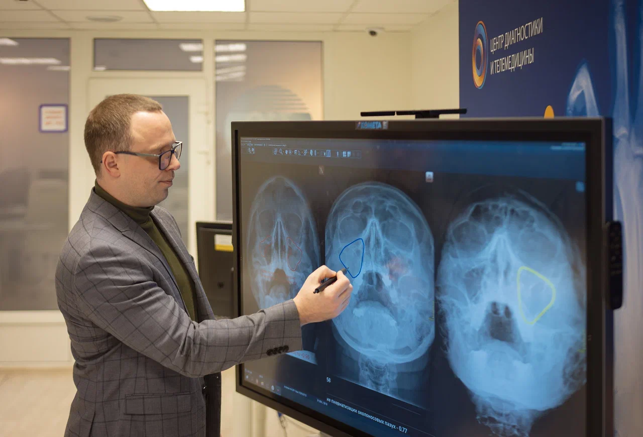 В Москве впервые искусственный интеллект начал выявлять ЛОР-заболевания на рентгене