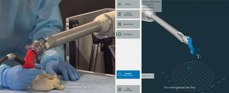 Американский стартап привлек $15 млн на робота-помощника для ЛОР-операций