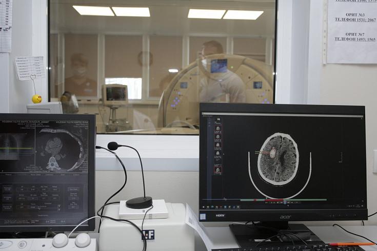 Искусственный интеллект научился определять признаки инсульта на томографии