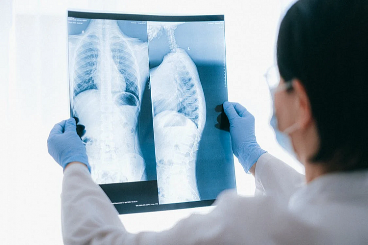 В России зарегистрирован ИИ-сервис для анализа цифровых рентгенограмм органов грудной клетки